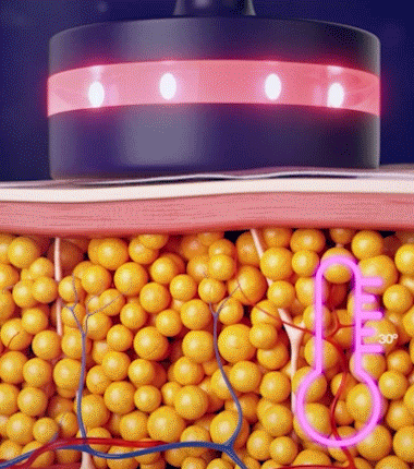 animation-burns.gif