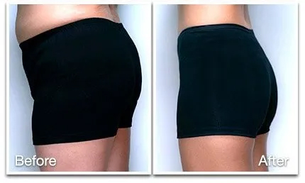 hips.jpg