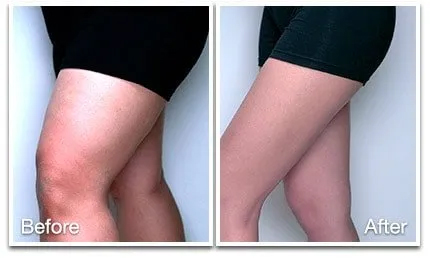 thighs.jpg