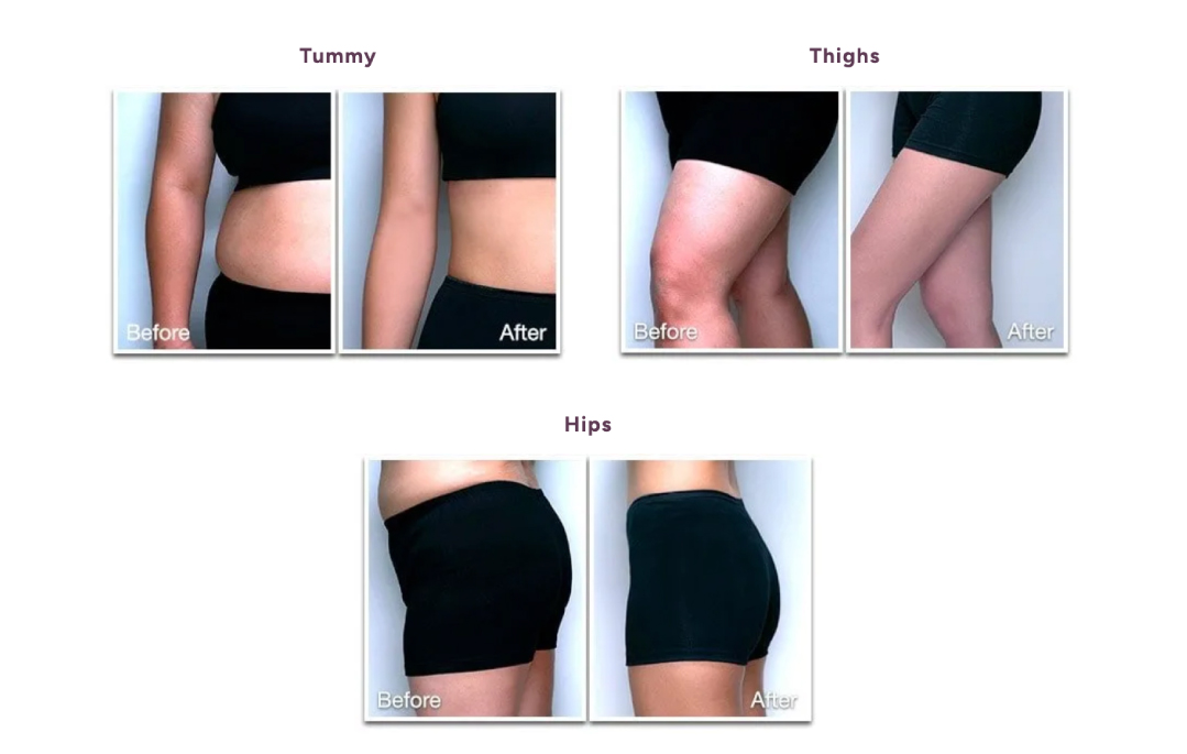 dorra_slimming_body.jpg